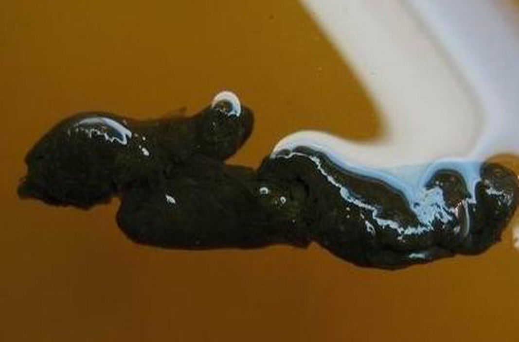 便秘又便溏怎么处理