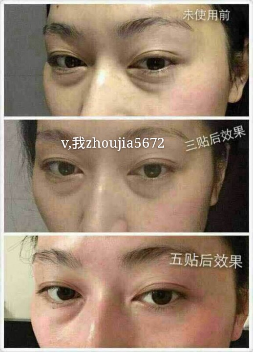 手机蓝屏越来越大怎么办啊视频教程