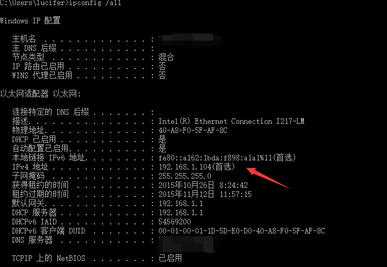 肿么查看这根网线的IP?