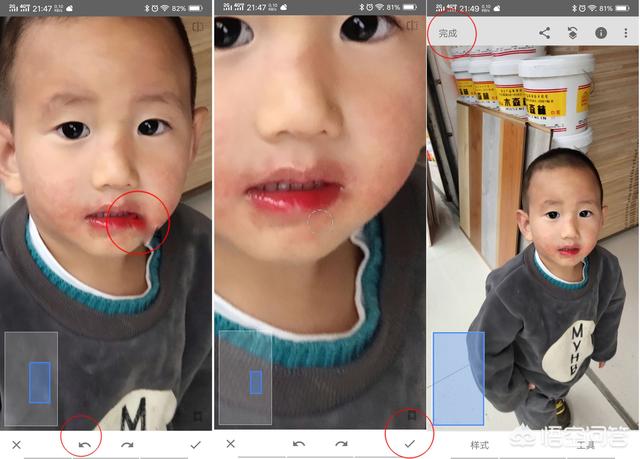 怎样用手机修图软件去掉照片人像脸上的痘痘?