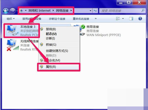 我的笔记本没法连接无线网DNS错误