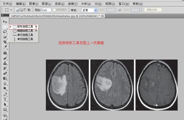 word肿么在图片上面加方框