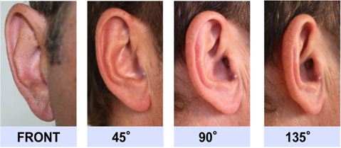 隐形助听器什么品牌的好?价格比较实惠的